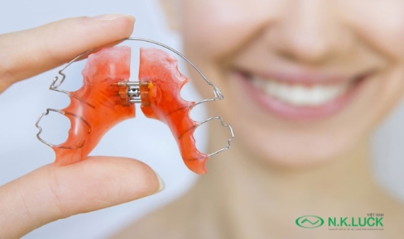 Hàm duy trì được sử dụng sau khi niềng răng