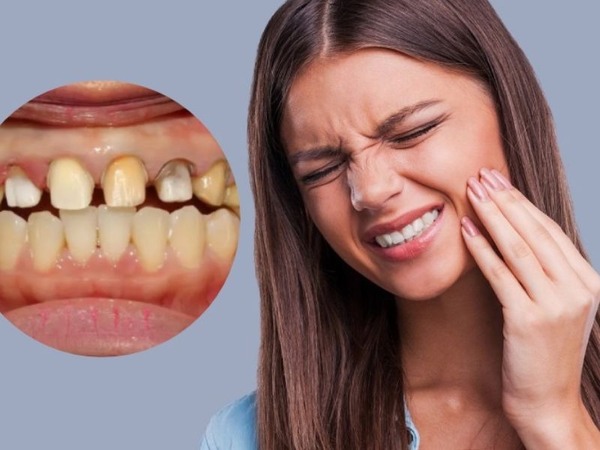 Đau nhức khi bọc răng sứ Đau nhức khi bọc răng sứ