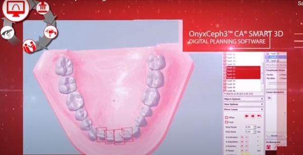 Phần mềm OnyxCeph3TM CA® SMART 3D