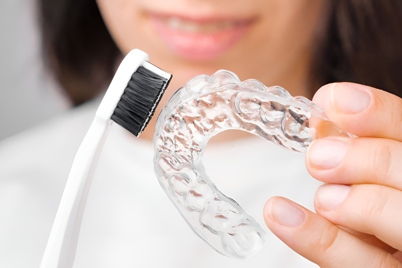 Niềng răng không mắc cài tiện lợi, dễ dàng vệ sinh Niềng răng không mắc cài tiện lợi, dễ dàng vệ sinh