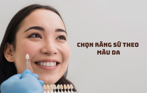 Chọn răng sứ theo màu da là một trong những cách chọn màu răng sứ thẩm mỹ