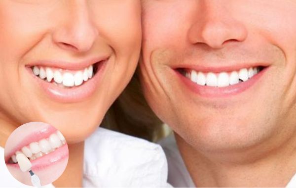Chọn màu răng sứ theo giới tính là cách chọn màu răng sứ thẩm mỹ hiệu quả