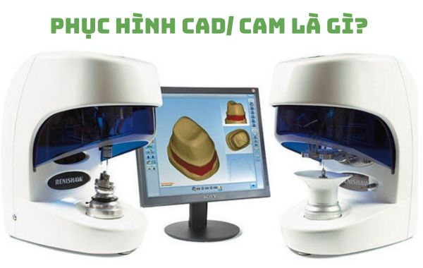 Tìm hiểu về phục hình CAD/ CAM