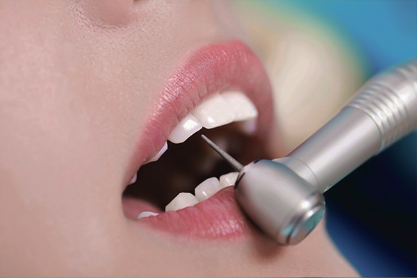 Những ảnh hưởng của việc mài răng nha khoa
