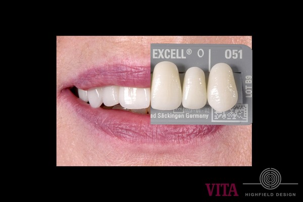 Phương án răng giả tháo lắp có thể áp dụng cho nhiều tình trạng, bao gồm mất một răng, mất nhiều răng hoặc thậm chí là toàn bộ hàm răng