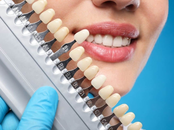 Tẩy trắng răng giúp răng trở nên trắng sáng hơn mà không làm hại đến bề mặt răng