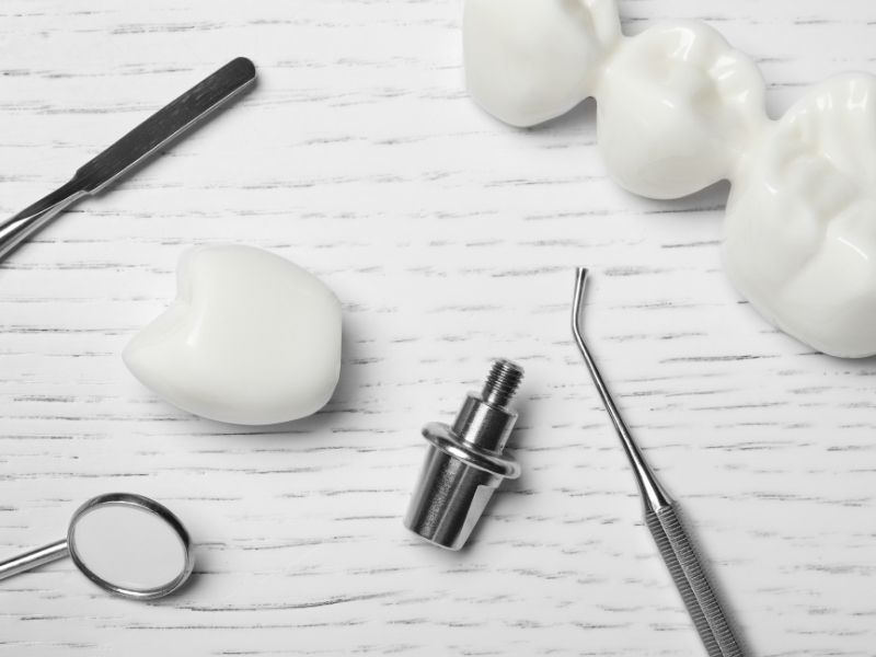 Trường hợp răng cần phải mài cùi