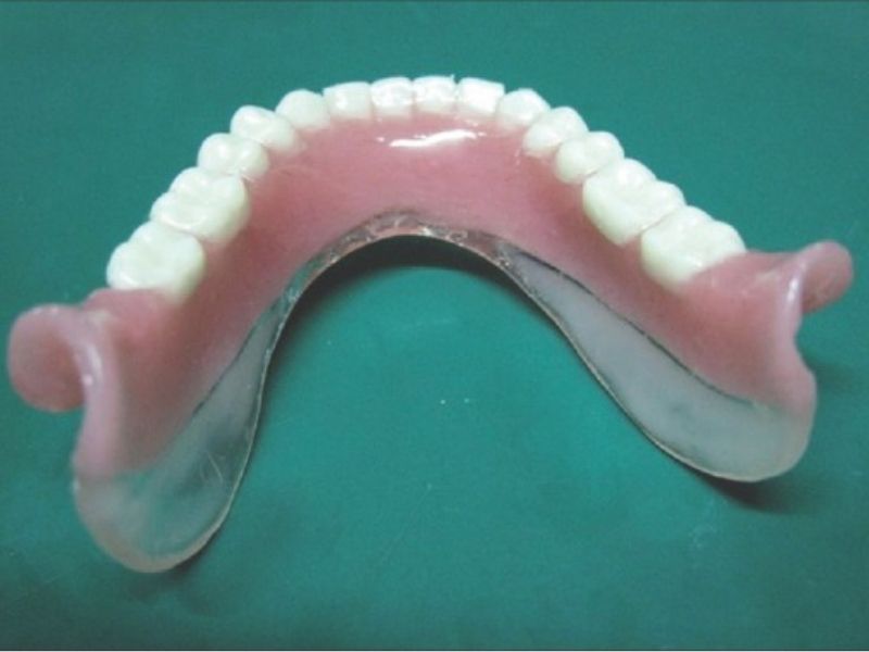 Răng tháo lắp bằng nhựa cứng Acrylic