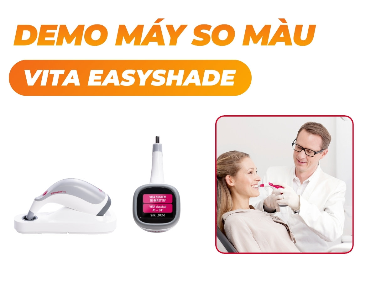 VITA so màu răng