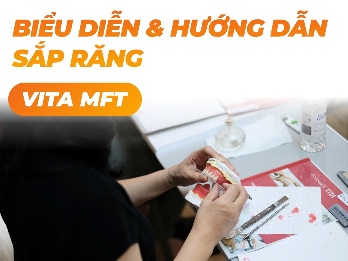 Biểu diễn sắp răng VITA