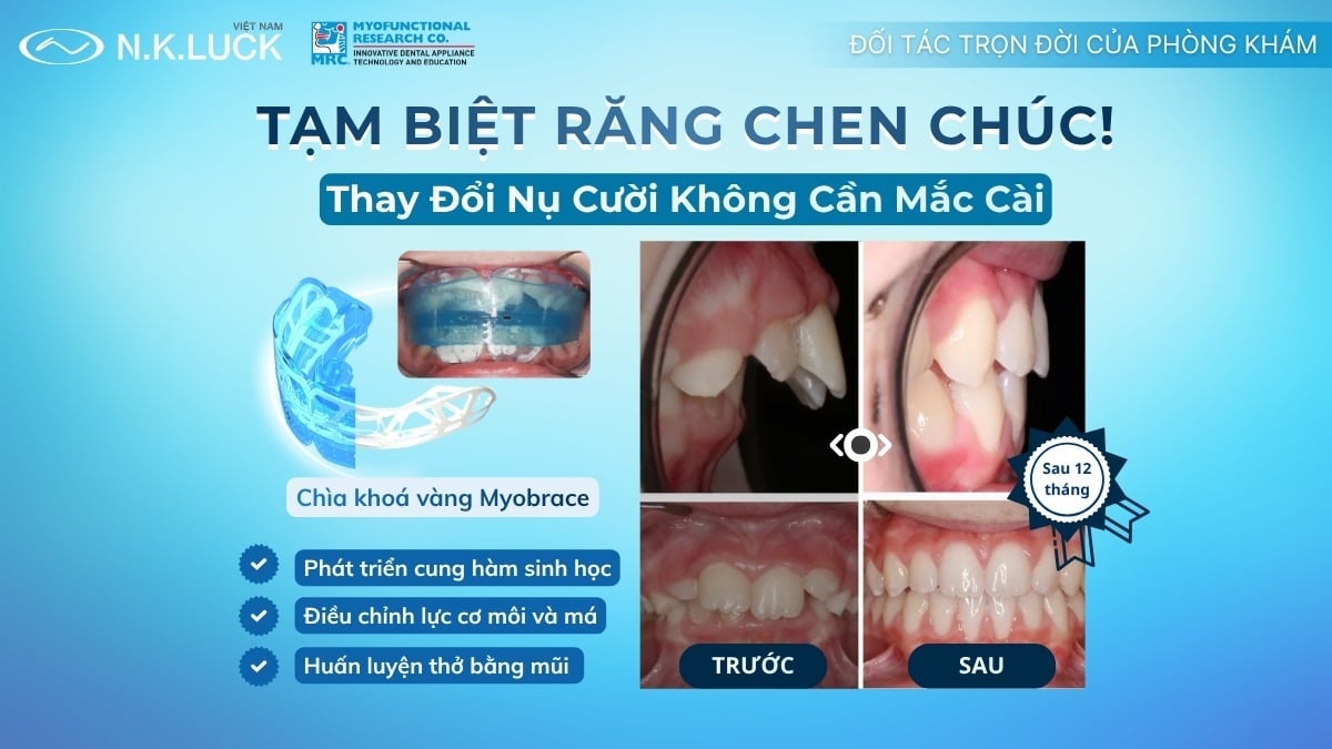 [COMING SOON] MRC COMPREHENSIVE COURSE VIETNAM 2026