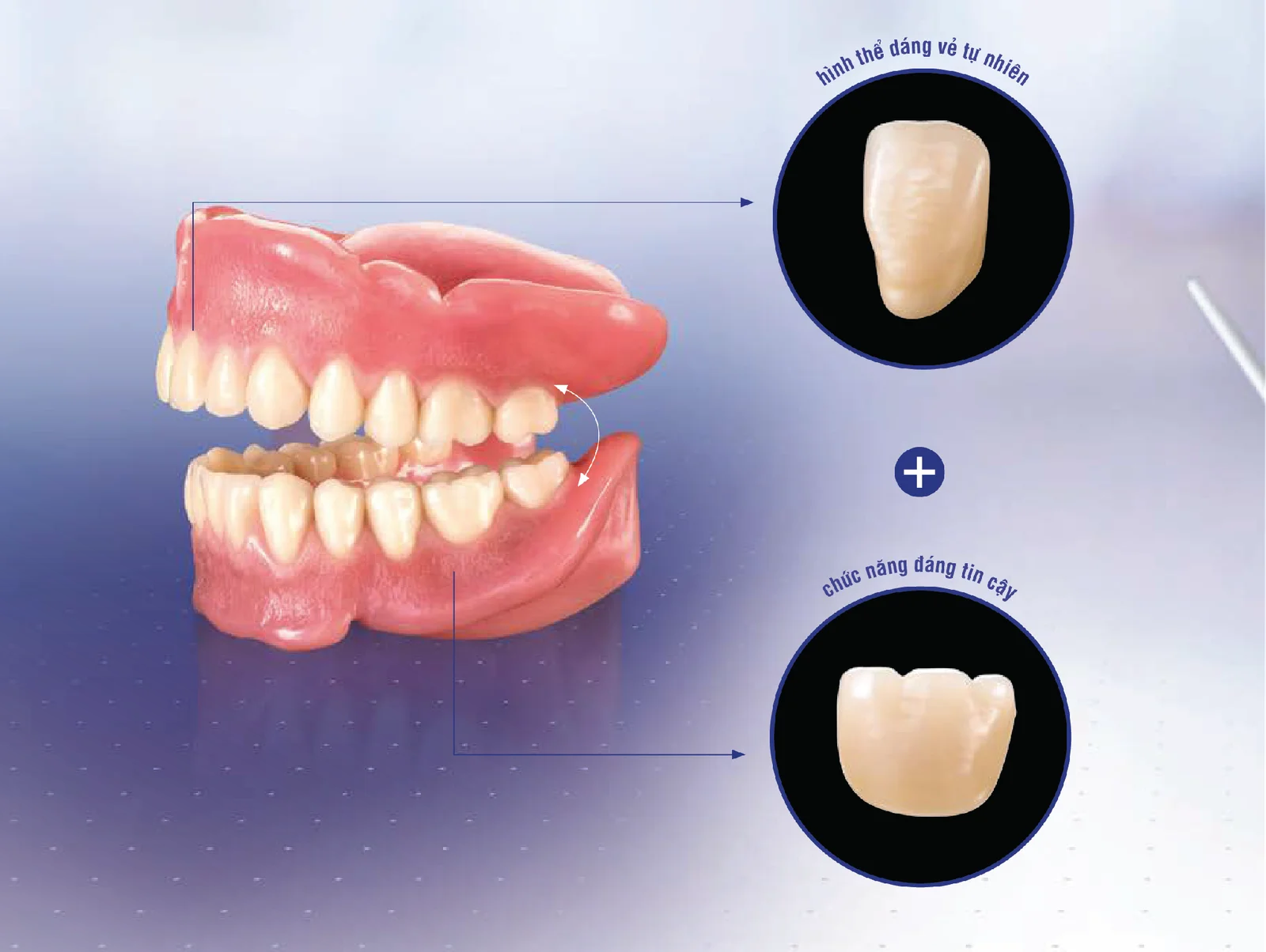 VITA MFT® Anterior - Răng cửa