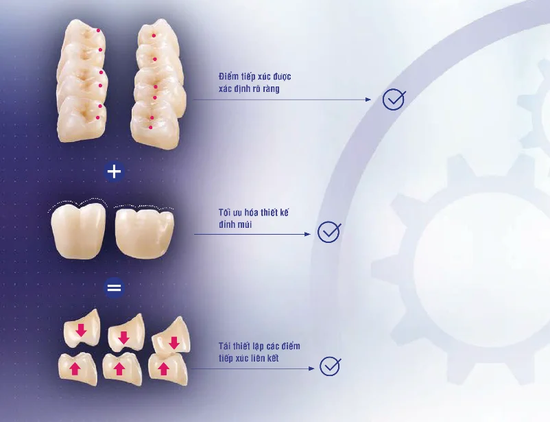 VITA MFT® Anterior - Răng cửa