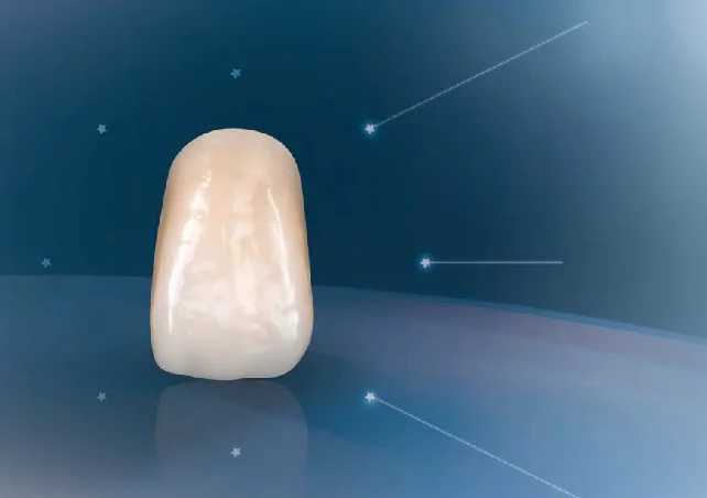 VITAPAN EXCELL® Anterior