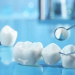 Tìm hiểu các loại răng sứ phổ biến hiện nay