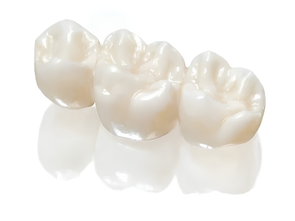 Răng sứ Orodent có độ chịu lực cao, khoảng 1.200 – 1.400 MPa