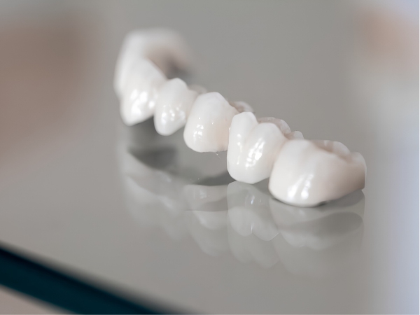 Răng sứ Ceramill sử dụng sườn Zirconia kết hợp lớp sứ phủ Zolid