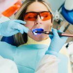 Tìm hiểu về các loại đèn trám răng