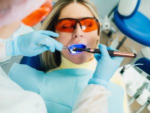 Tìm hiểu về các loại đèn trám răng