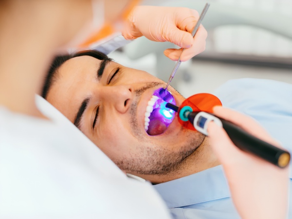 Đèn sử dụng ánh sáng năng lượng cao để kích hoạt phản ứng polymer hóa