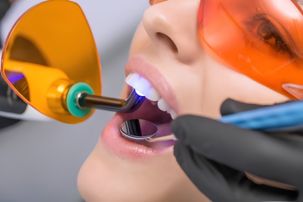 Đèn Laser Polymer hóa có tính định hướng cao