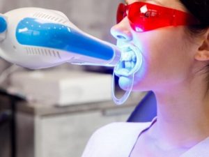 Chi tiết cách dùng đèn tẩy trắng răng nha khoa với N.K.LUCK