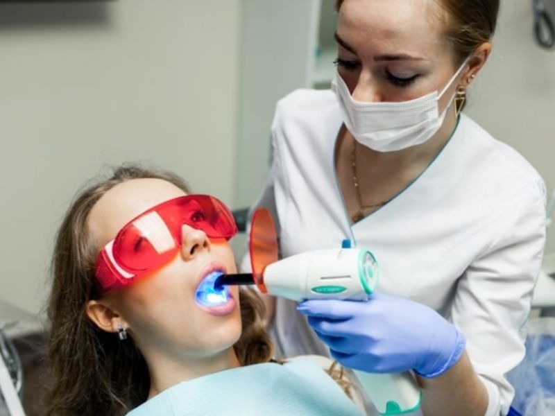 Những lỗi thường gặp khi sử dụng đèn tẩy trắng răng