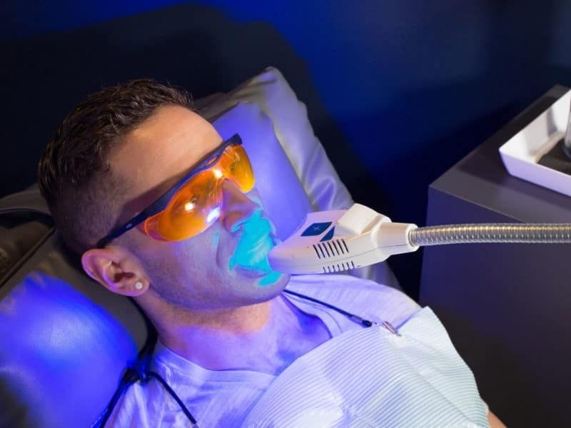 Lưu ý an toàn khi dùng đèn tẩy trắng răng nha khoa