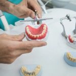 Tìm hiểu ưu nhược điểm của răng giả tháo lắp