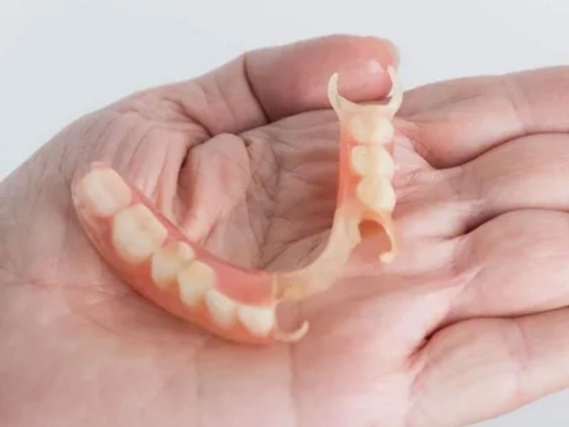 Ưu điểm của răng giả tháo lắp