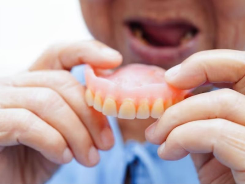 Các trường hợp được chỉ định răng giả tháo lắp