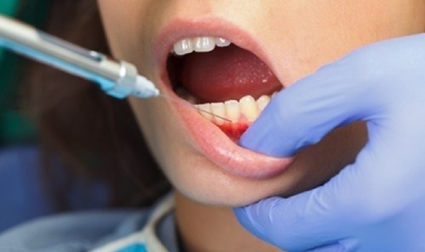 Giảm đau khi mài răng bọc sứ