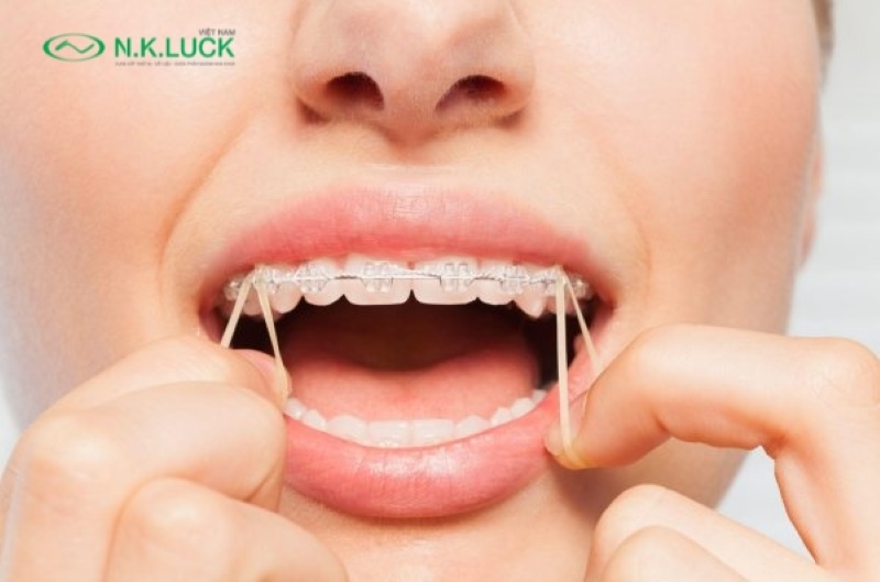 Thun liên hàm là khí cụ có độ đàn hồi cao