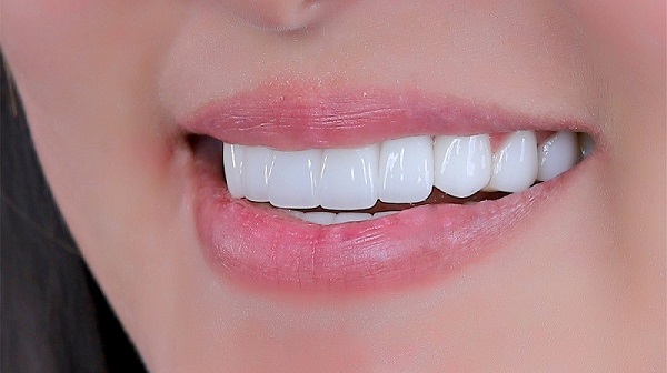 Răng có 3 chức năng chính là nhai, phát âm và thẩm mỹ