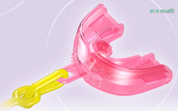 khí cụ chỉnh nha