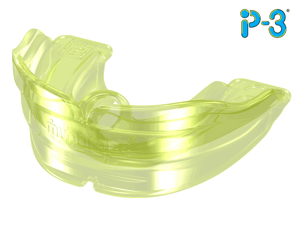 myobrace for interceptive P3R trước