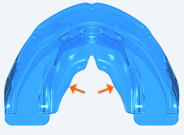 myobrace for kid K3 sau