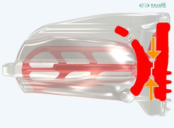 myobrace for kid broad K2 sau