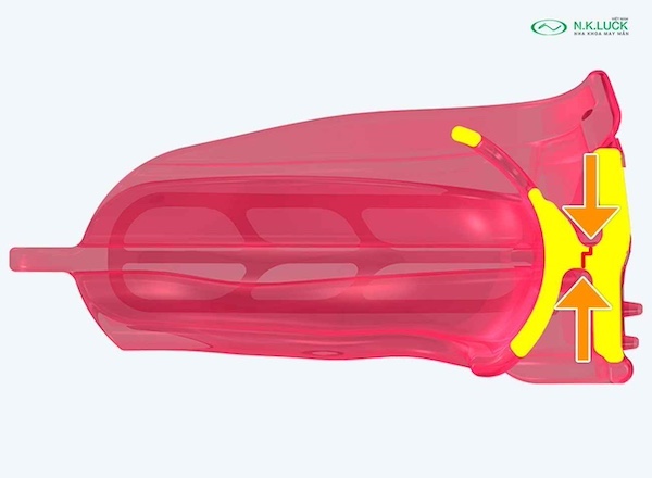 myobrace for kid broad K3 sau