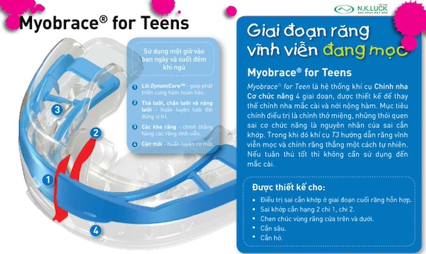 myobrace for teen