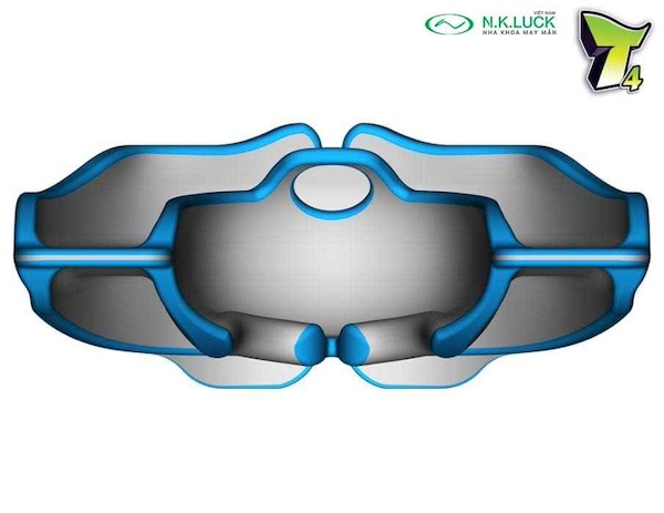 myobrace for teen T4 trước