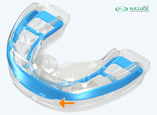 myobrace for teen T3 sau