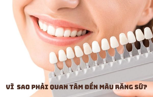 Tại sao cần phải có cách chọn màu răng sứ thẩm mỹ phù hợp? Tại sao cần phải có cách chọn màu răng sứ thẩm mỹ phù hợp?
