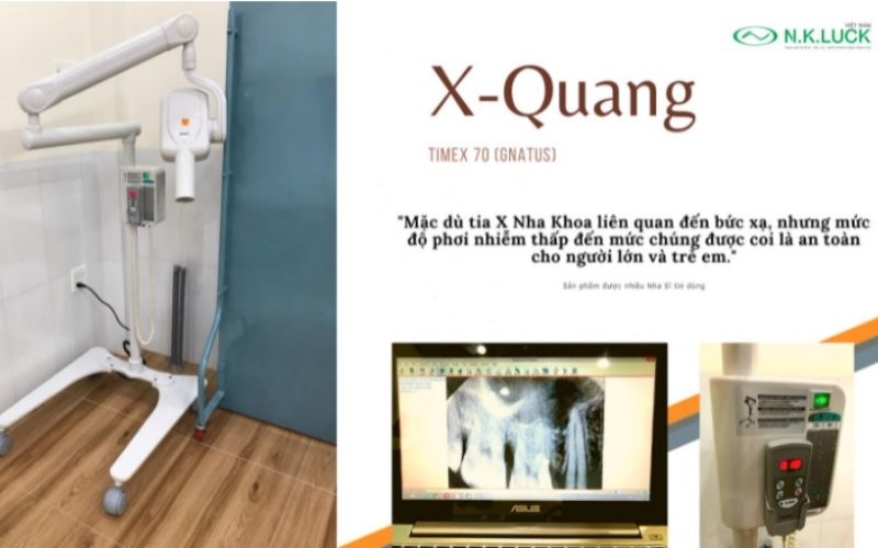 Hình ảnh lắp đặt x-quang tại Nha Khoa Anh Tuấn