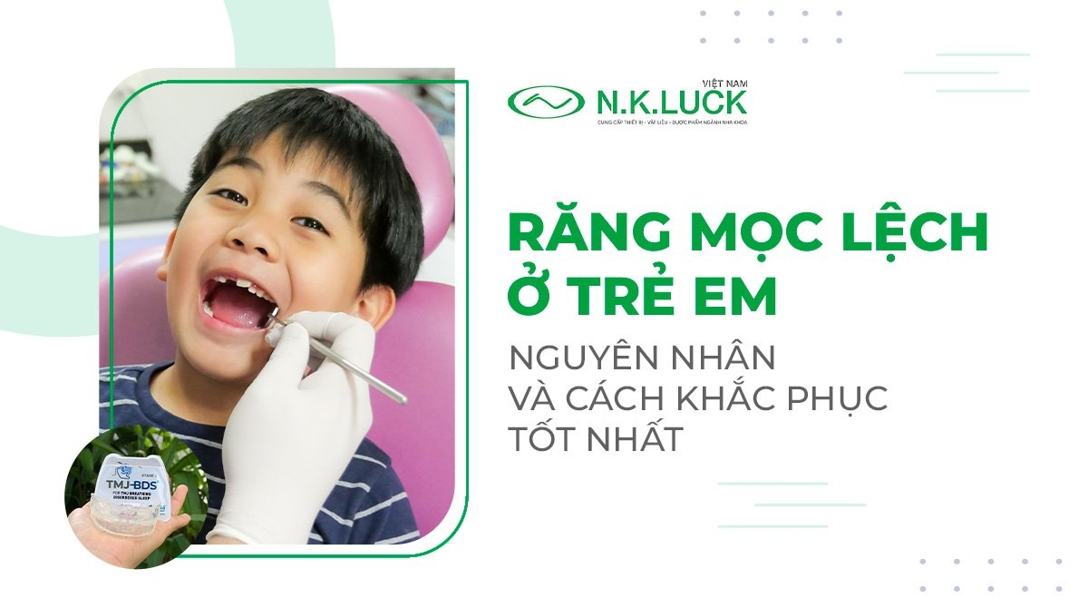 Nguyên nhân răng mọc lệch ở trẻ em và cách khắc phục tốt nhất