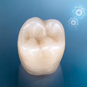 VITAPAN® LINGOFORM Posterior