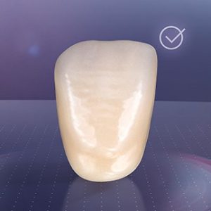 VITA MFT® Anterior - Răng cửa