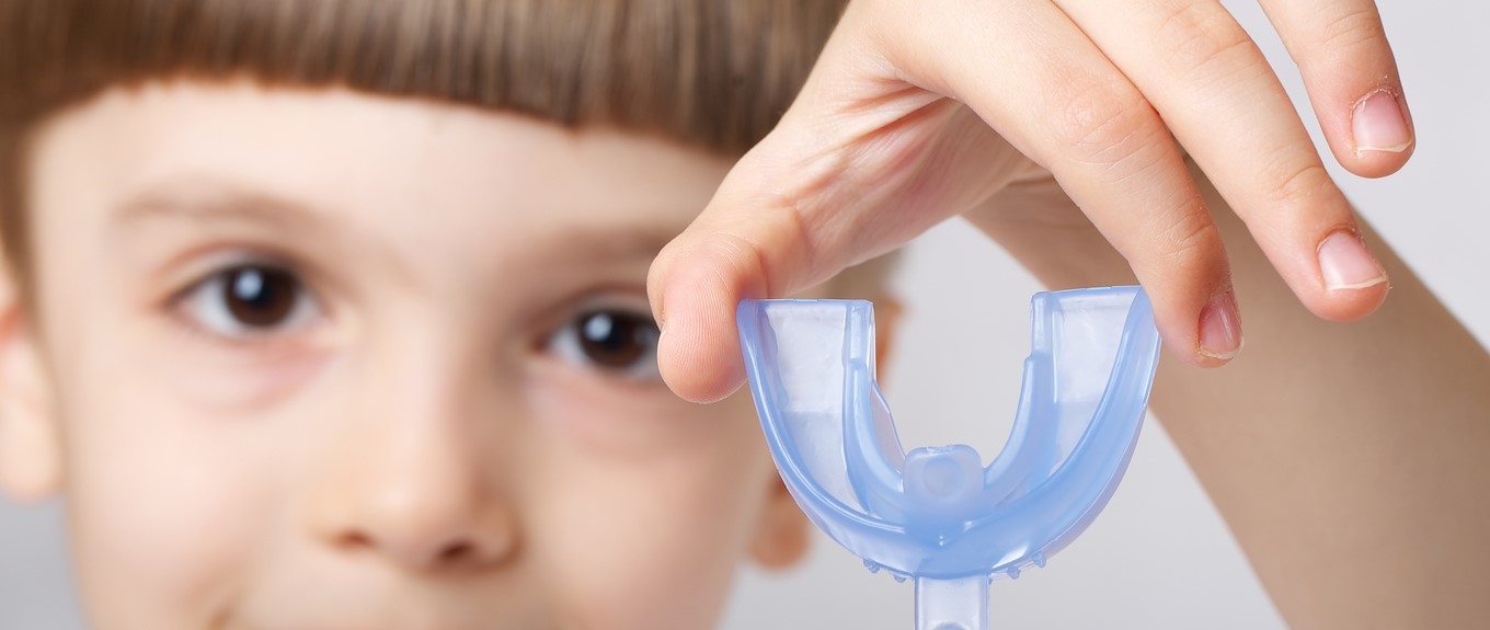 Những điều cần biết về chỉnh nha tháo lắp