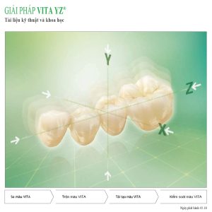 Giải pháp VITA YZ